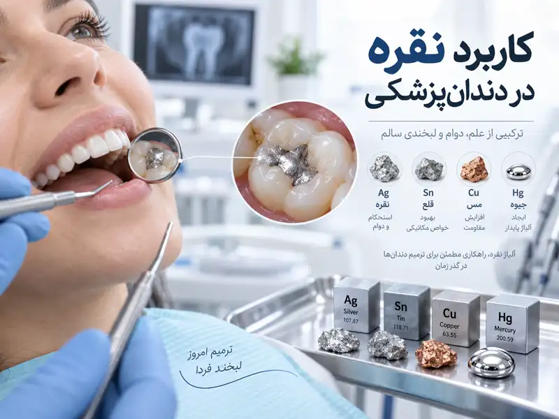 کاربرد نقره در دندانپزشکی